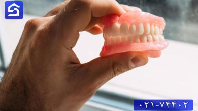 تصویر علت زرد شدن دندان مصنوعی