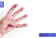 تصویر درمان سوختگی انگشت دست