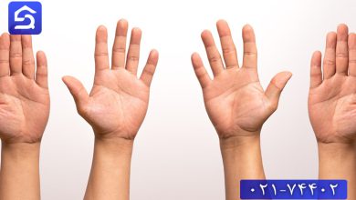تصویر درمان سوختگی سطحی دست