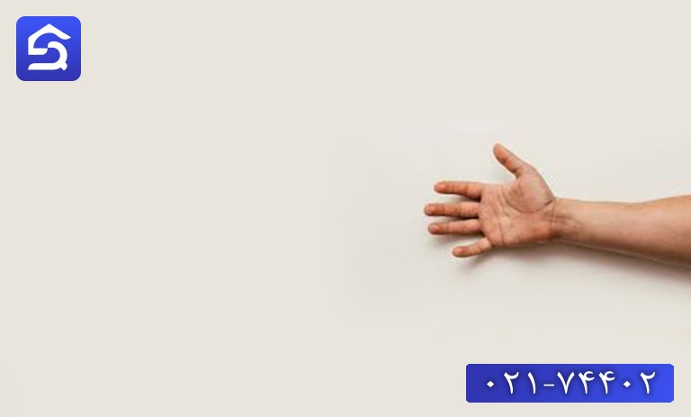 درمان سوختگی سطحی دست