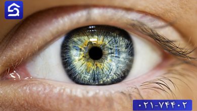 تصویر درمان سوختگی قرنیه چشم